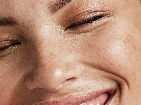 Close-up of a person's face, smiling with eyes closed. The skin is dotted with freckles and the overall expression appears joyful and relaxed.