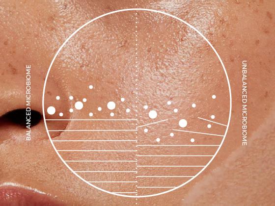 Close-up of a person's cheek with a circular diagram overlaid, illustrating the difference between balanced and unbalanced skin microbiome using dots and lines. The left side appears smoother, the right side more textured.