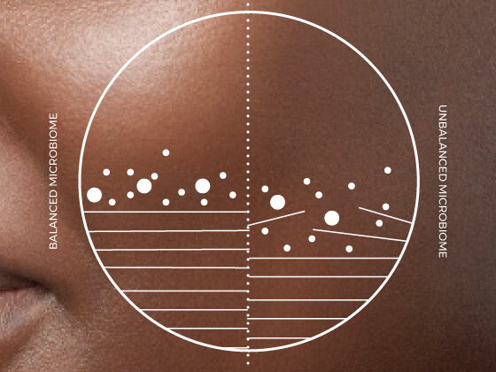A diagram overlaid on skin shows a circle divided in half; the left side, labeled "Balanced Microbiome," has even lines and dots, while the right, labeled "Unbalanced Microbiome," has irregular lines and uneven dots.