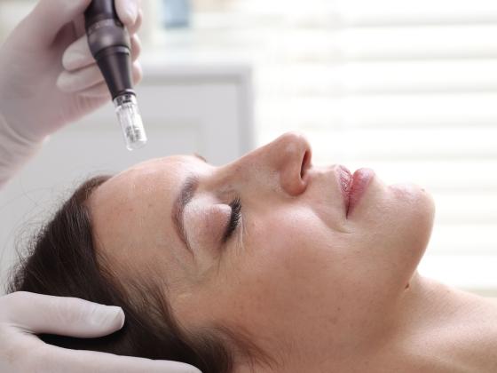 A woman lies with eyes closed while a gloved hand holds a microneedling device near her forehead, preparing for a skincare treatment in a clinical setting to address versnelde huidveroudering.