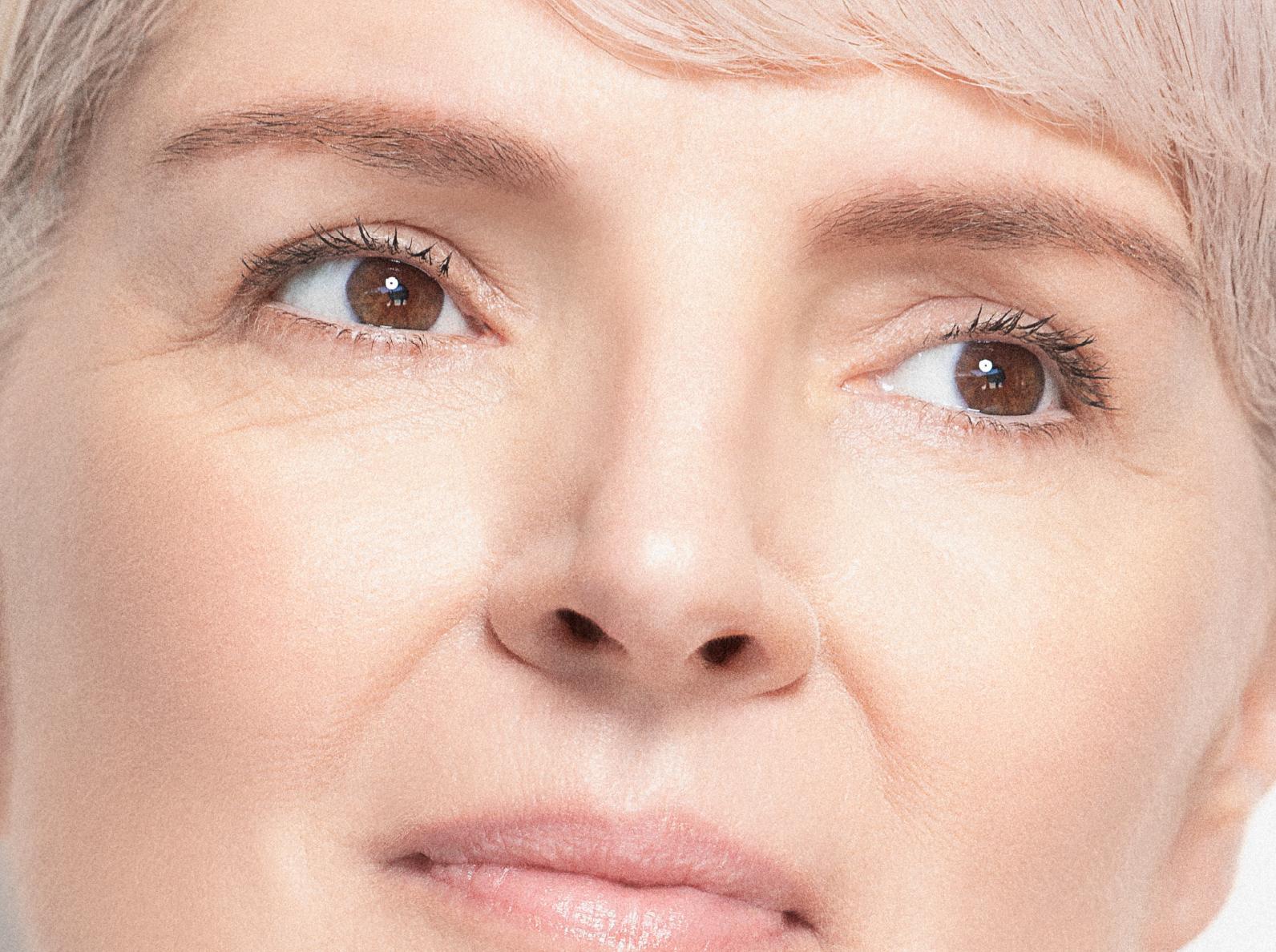 Close-up of a person's face, focusing on the eyes, nose, and upper cheeks. The person has light skin, brown eyes, and short, light-colored hair. The calm expression highlights the microbioom na esthetische behandeling effect.