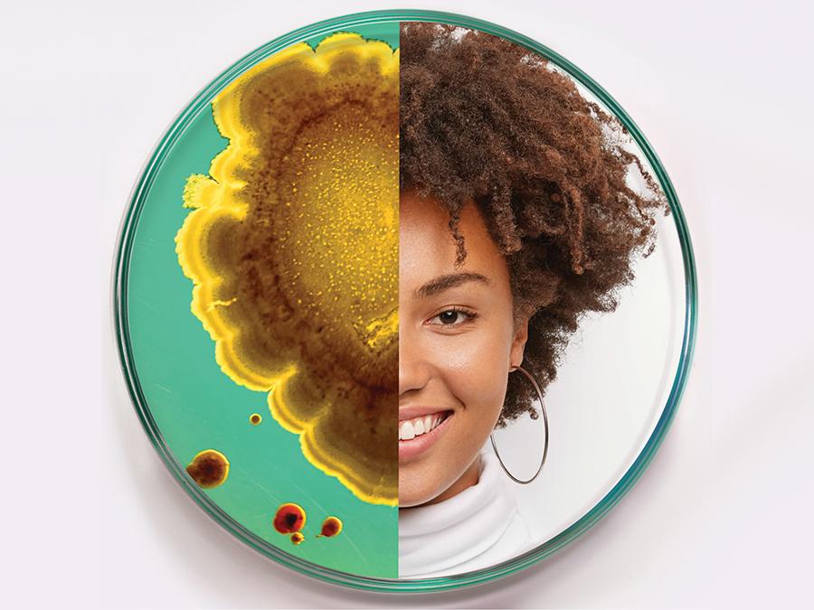 Microbes & your skin
